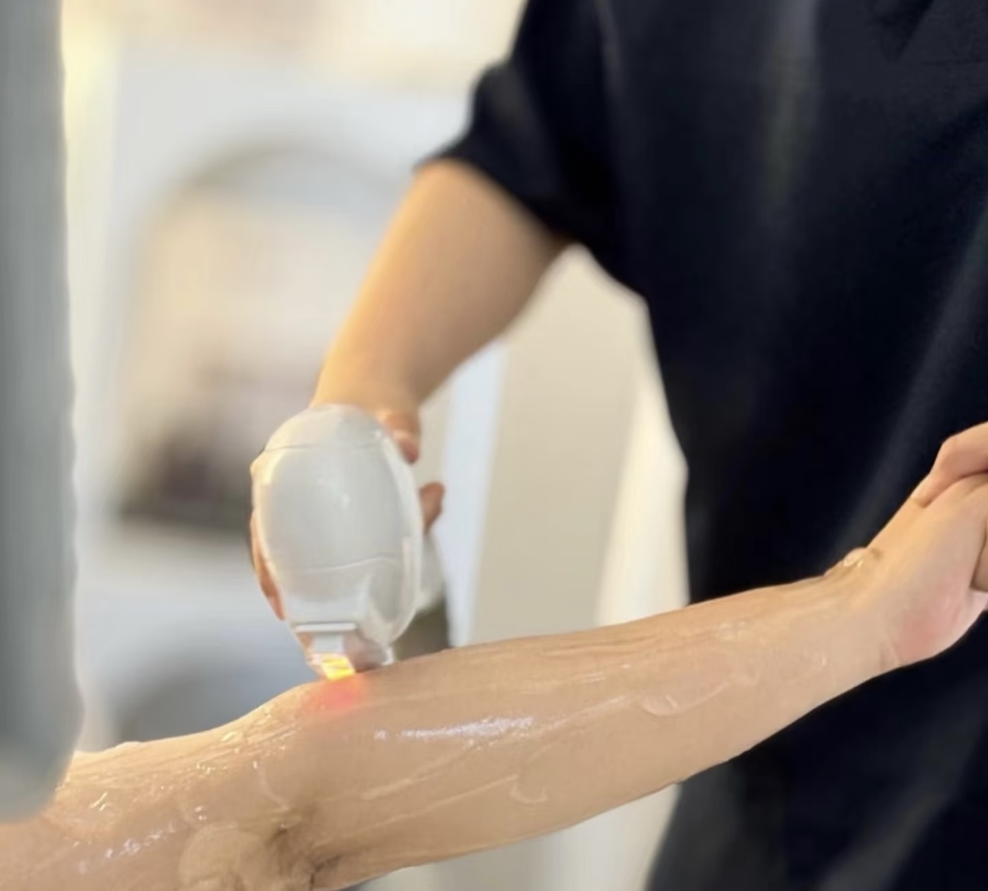 Laser hair removal treatment at Revitalized Beauty